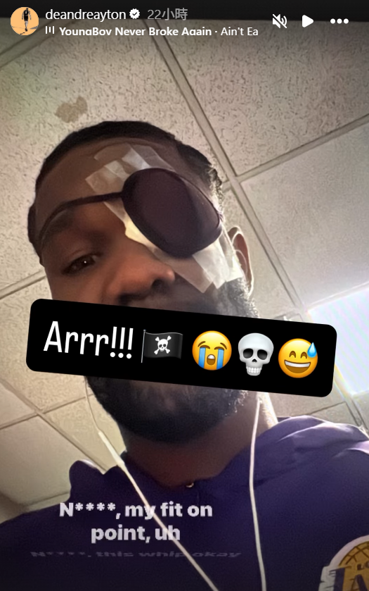 艾顿戴眼罩自嘲如「海盗」 湖人主帅曝眼睛状况不太好